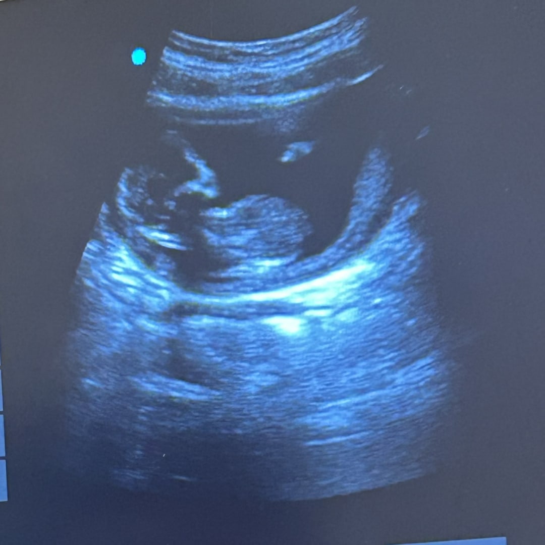 Photo shared by Whitney for their Babylist baby registry.
