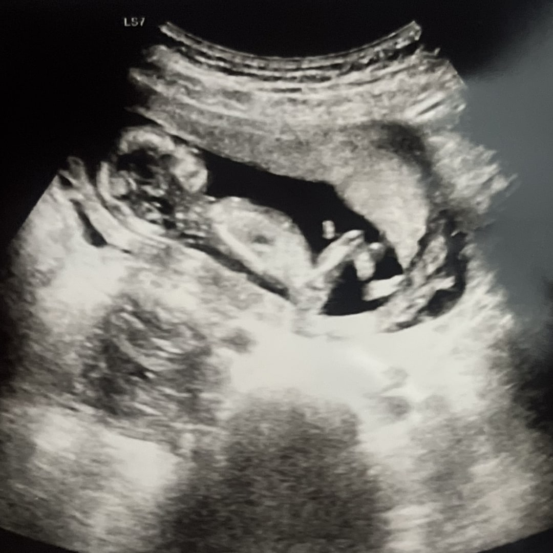 Photo shared by Amari for their Babylist baby registry.