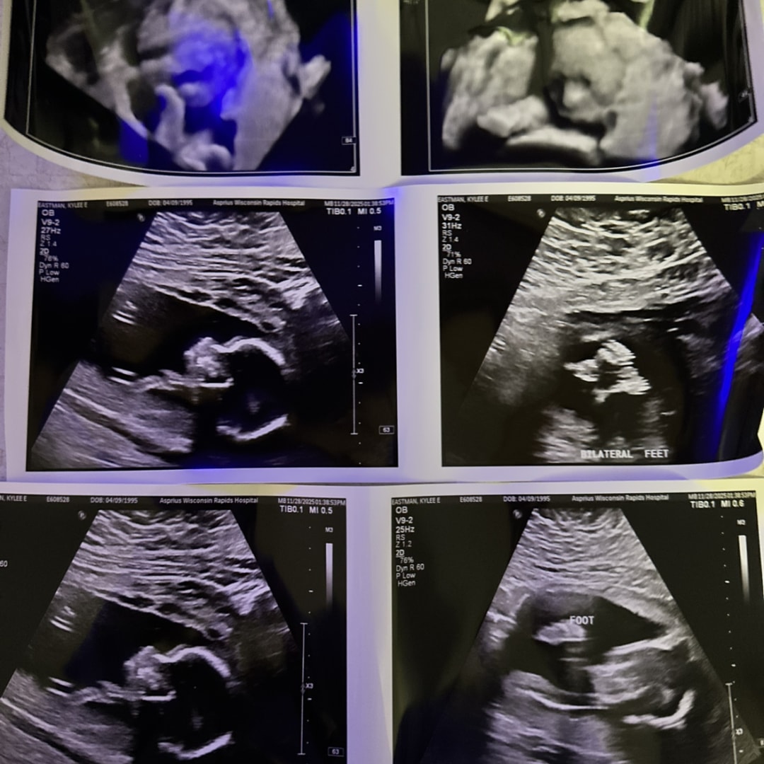 Photo shared by Kylee for their Babylist baby registry.