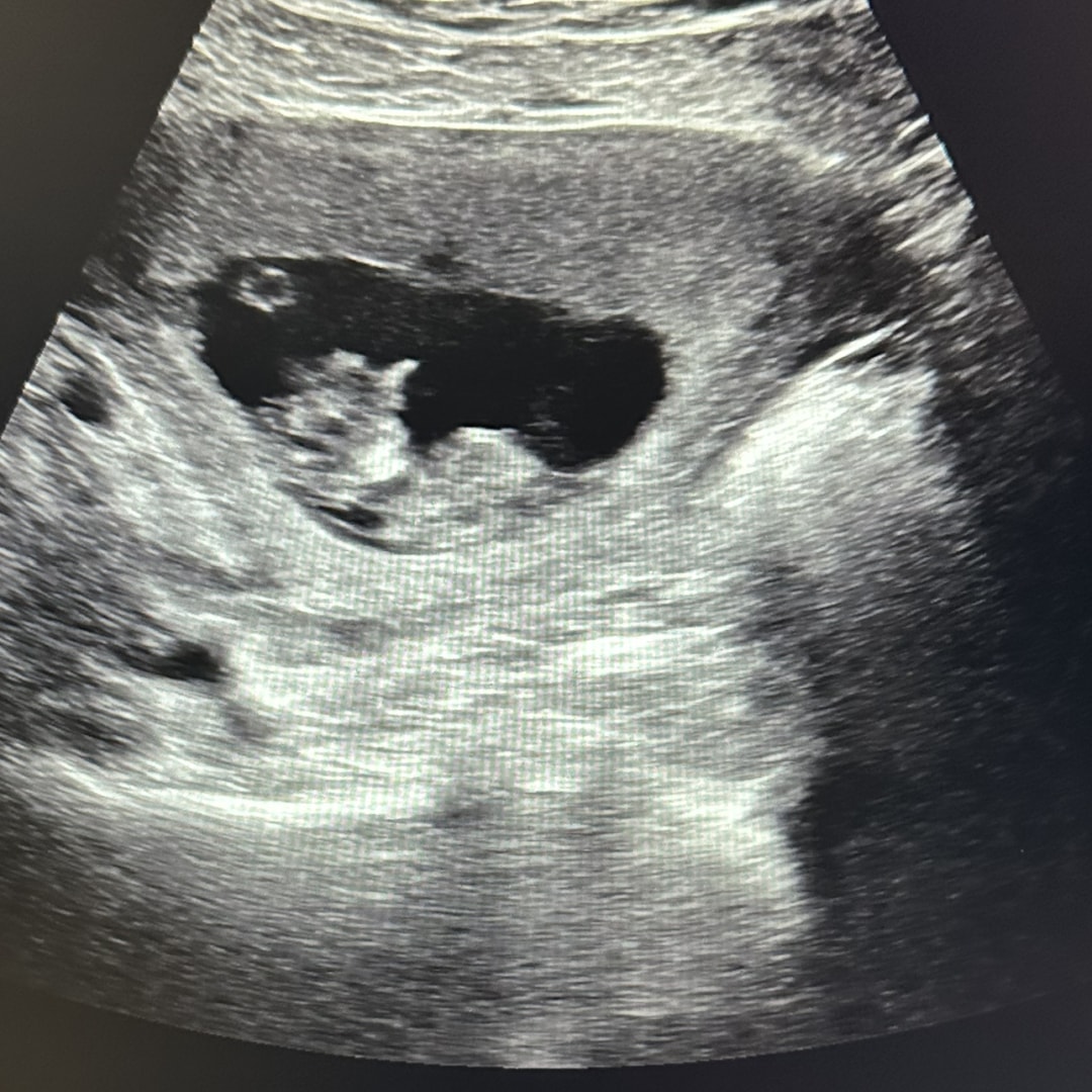 Photo shared by Cassidy for their Babylist baby registry.