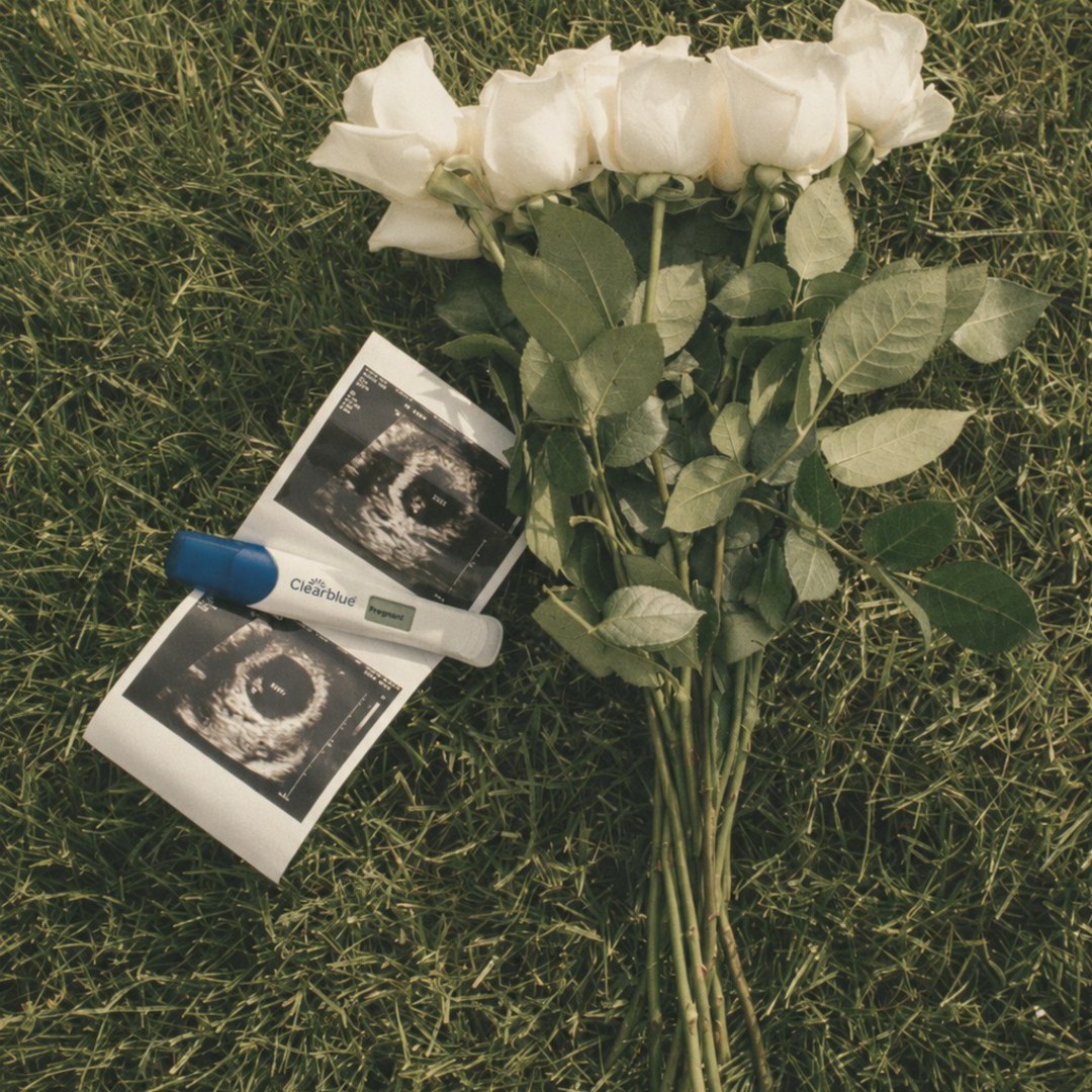 Photo shared by Anna for their Babylist baby registry.