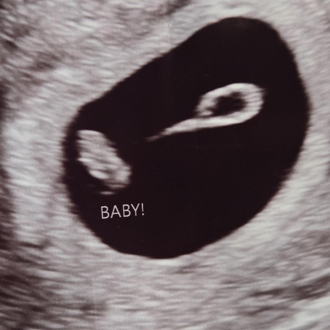 Photo shared by Alexa for their Babylist baby registry.