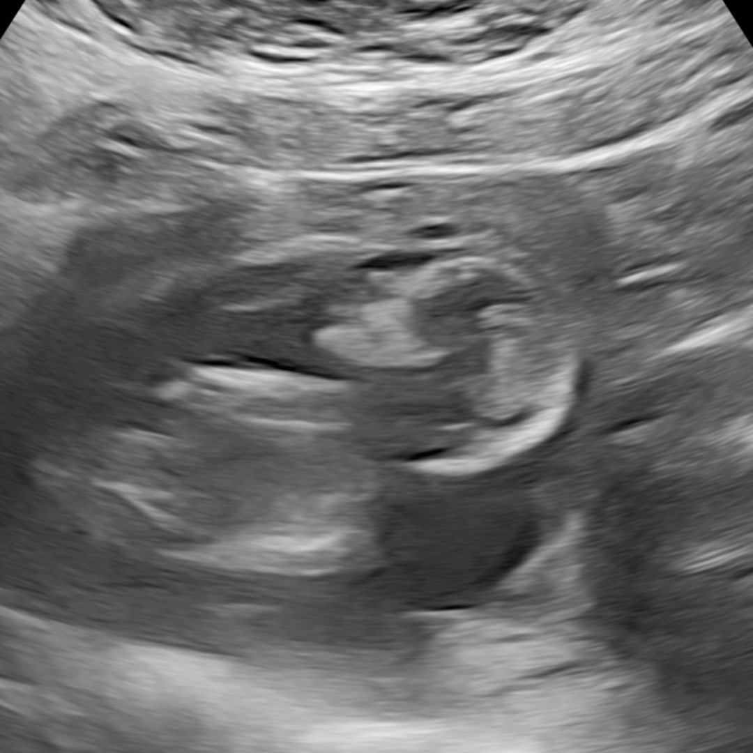 Photo shared by Kassandra for their Babylist baby registry.