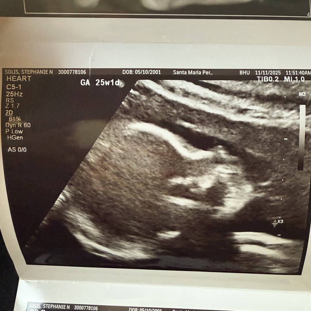 Photo shared by Stephanie for their Babylist baby registry.