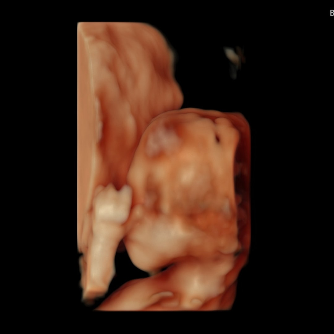 Photo shared by Annabelle for their Babylist baby registry.