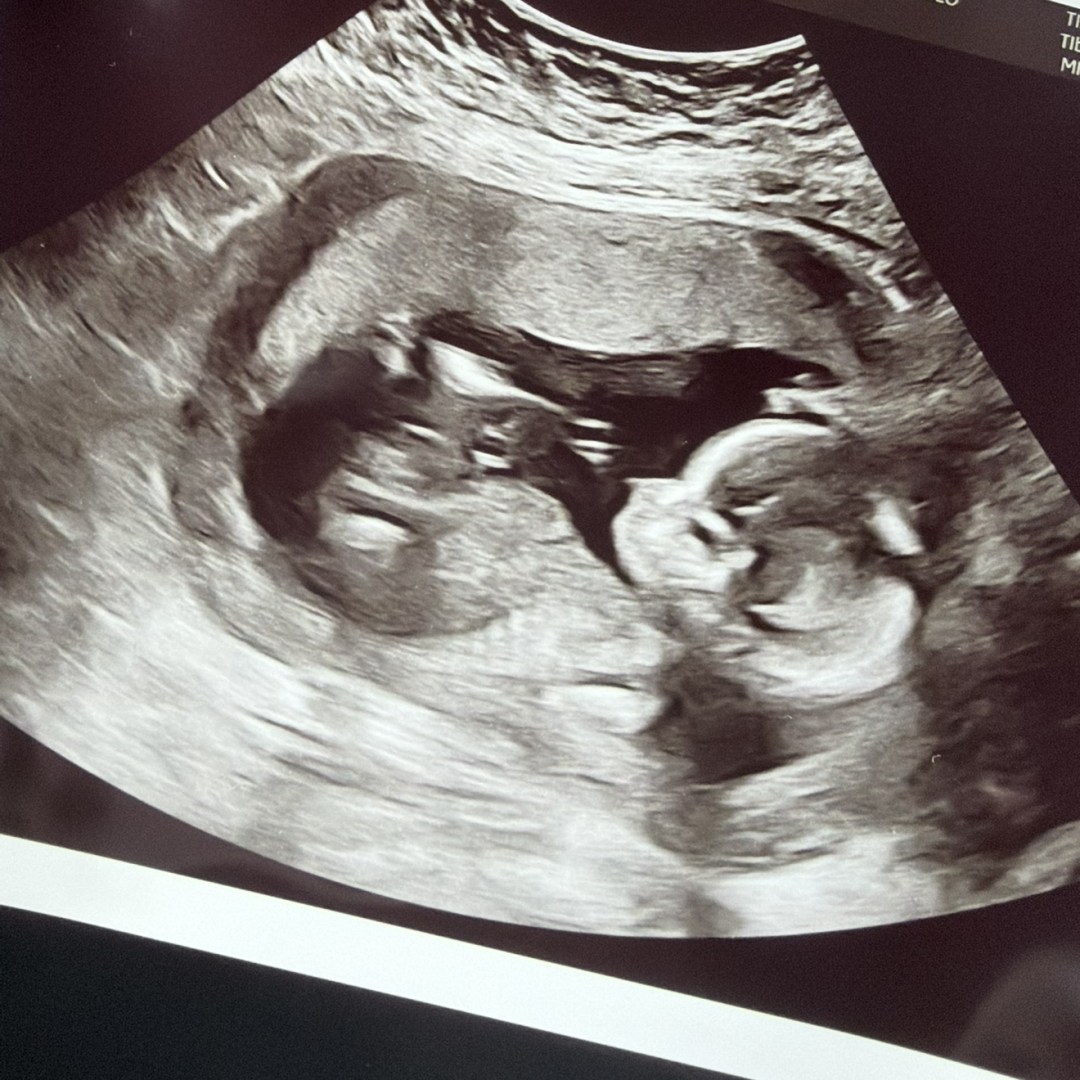 Photo shared by Anna for their Babylist baby registry.