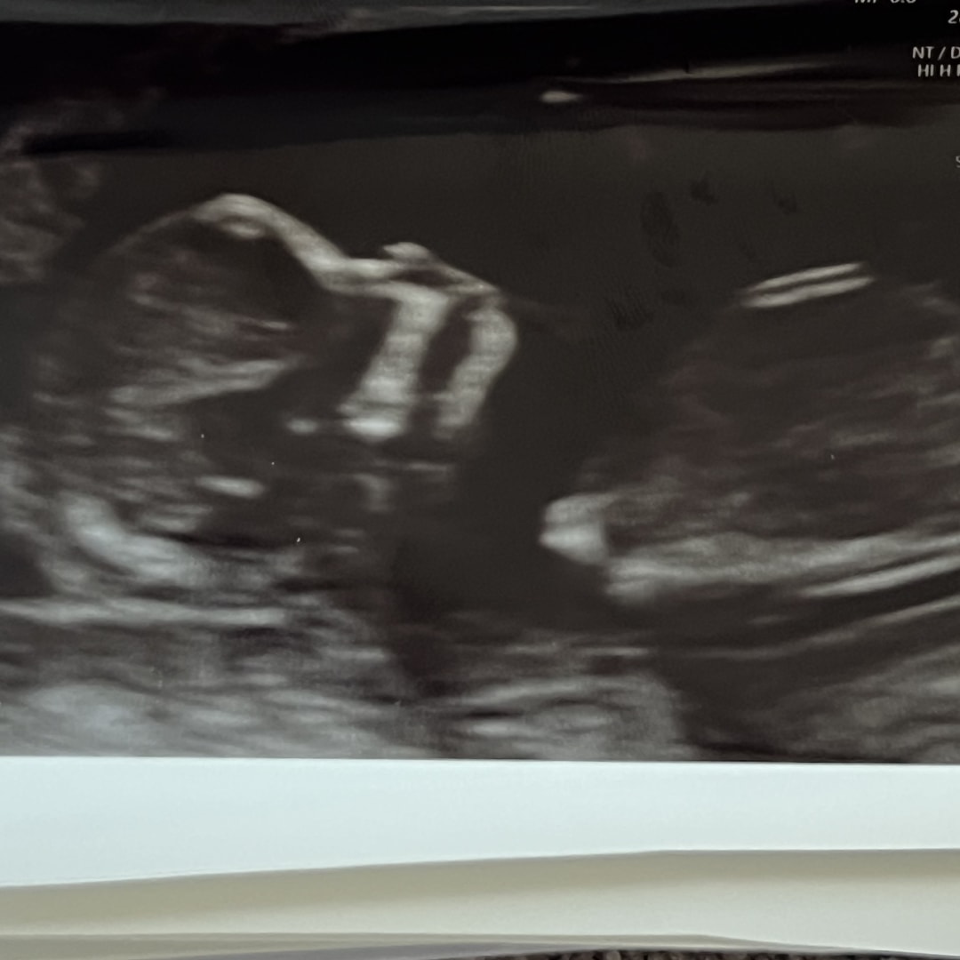 Photo shared by Cassidy for their Babylist baby registry.