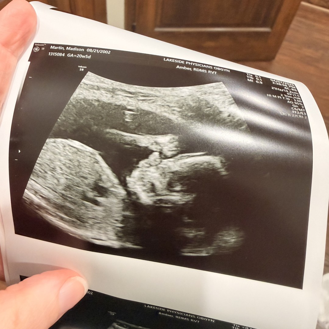 Photo shared by Madison for their Babylist baby registry.