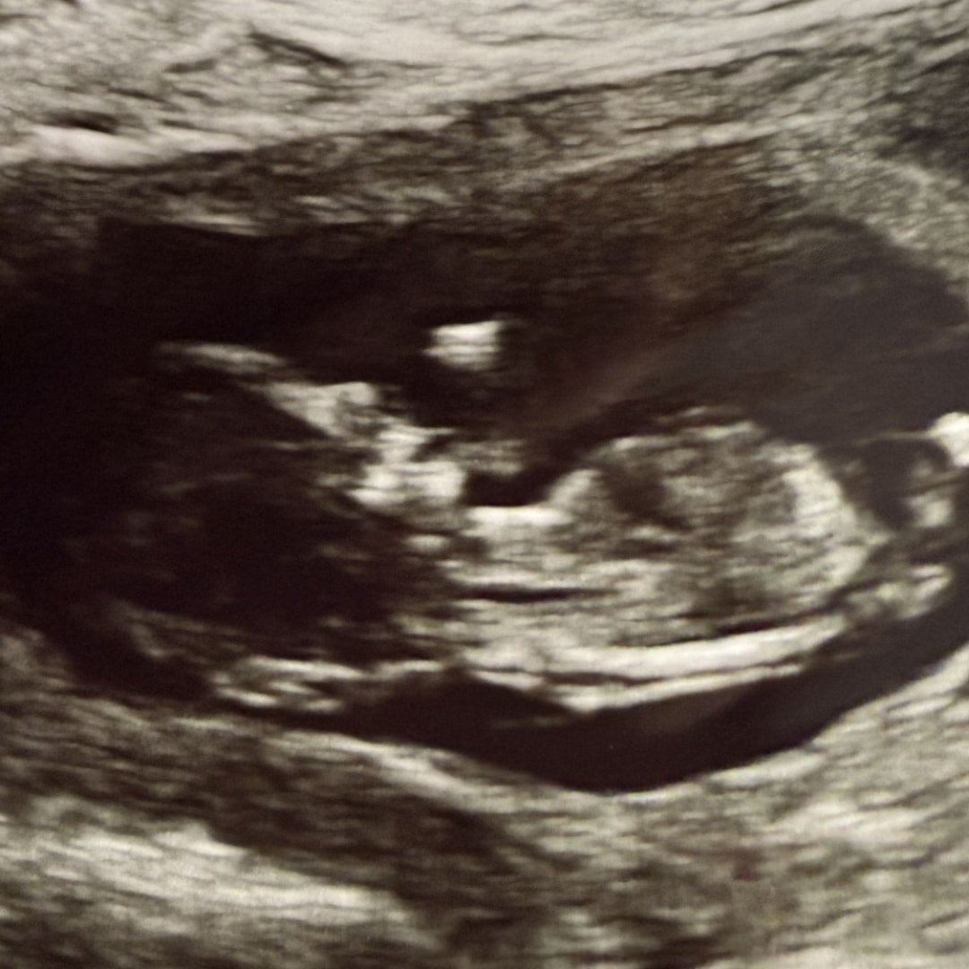 Photo shared by Katherine for their Babylist baby registry.