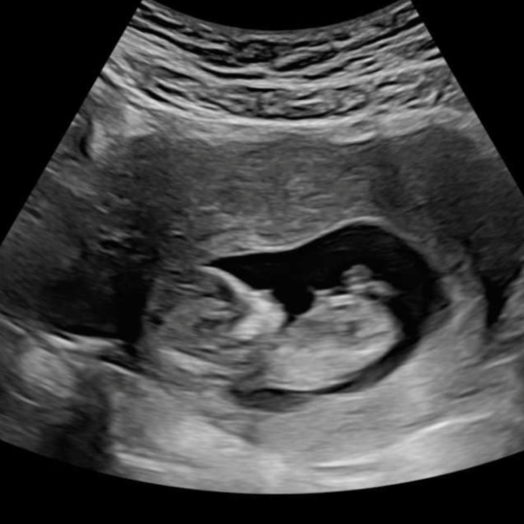 Photo shared by Jennifer for their Babylist baby registry.