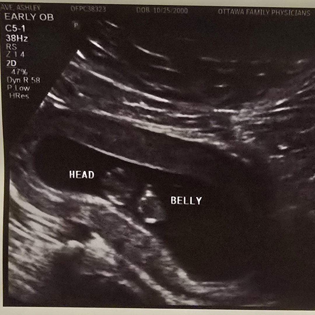 Photo shared by Ashley for their Babylist baby registry.