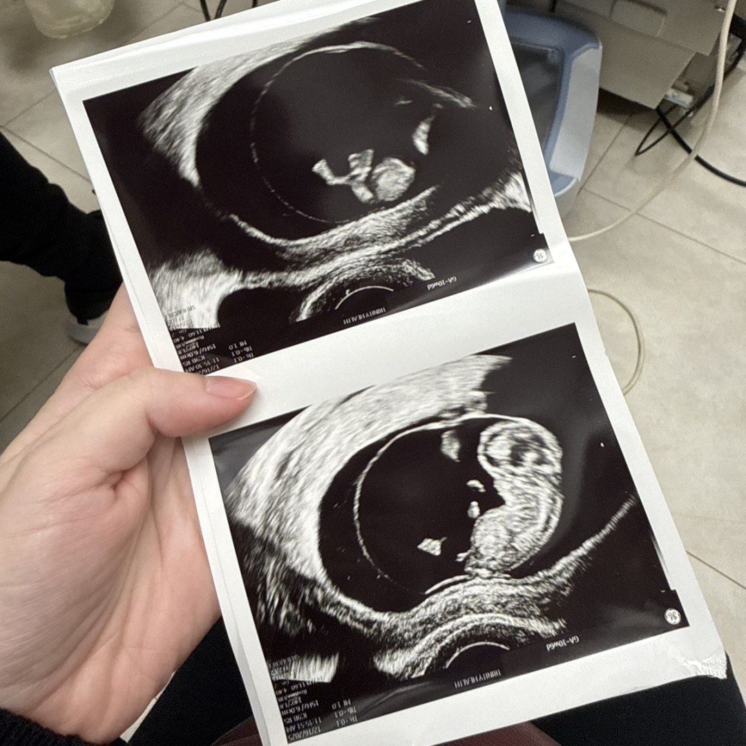 Photo shared by Allison for their Babylist baby registry.