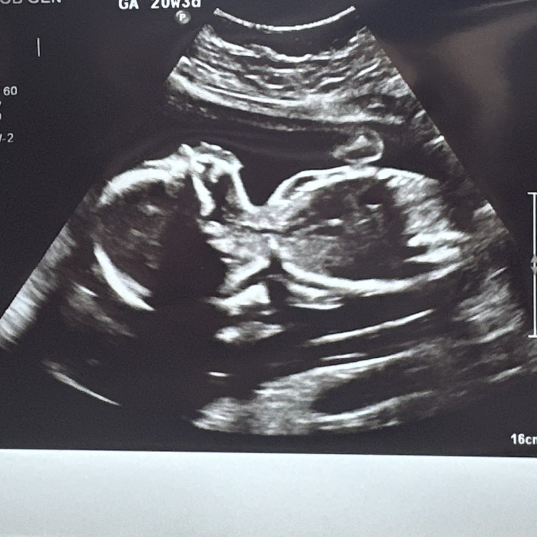 Photo shared by Jillian for their Babylist baby registry.