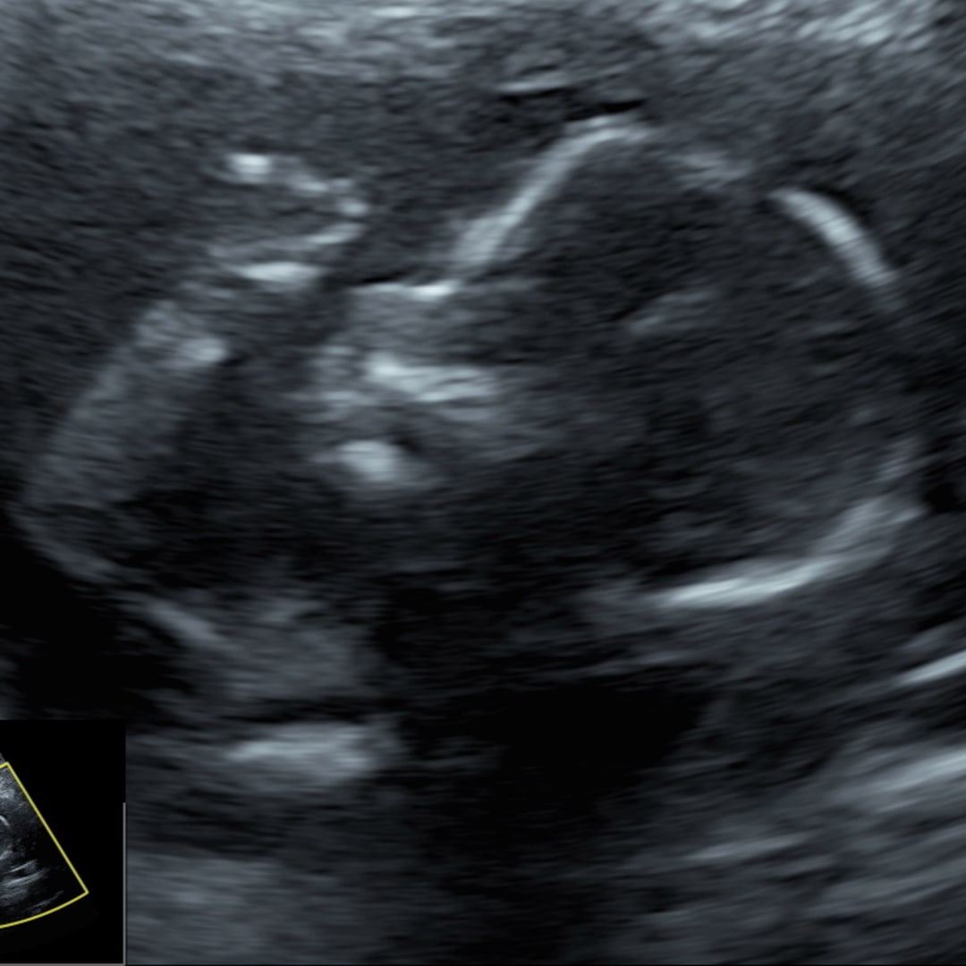 Photo shared by Ashley for their Babylist baby registry.