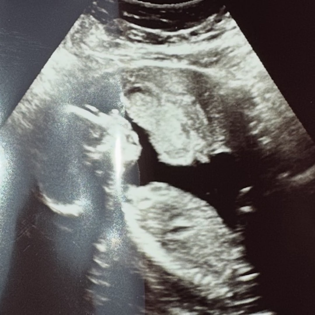 Photo shared by Stephanie for their Babylist baby registry.