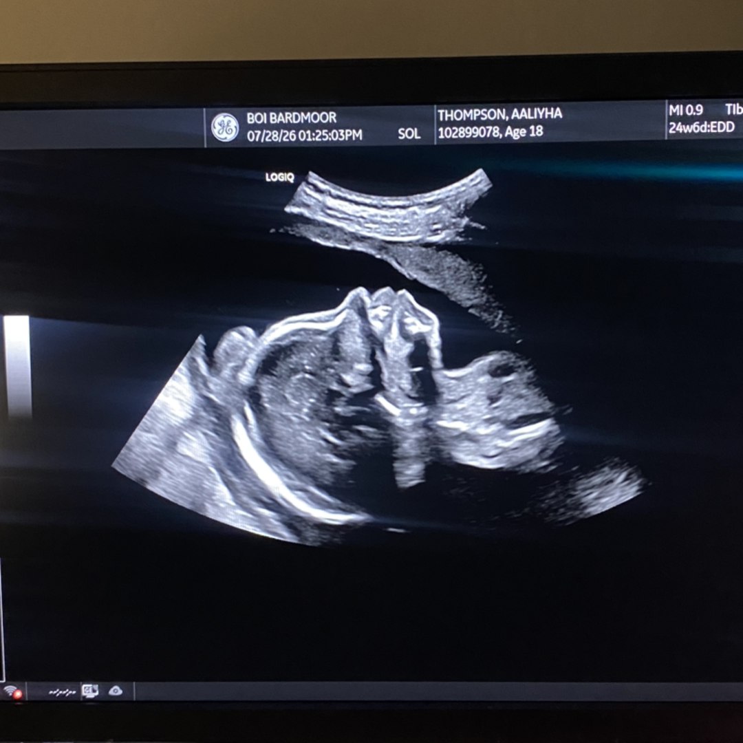 Photo shared by Aaliyha for their Babylist baby registry.