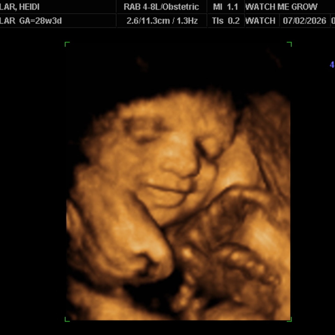 Photo shared by Heidi for their Babylist baby registry.