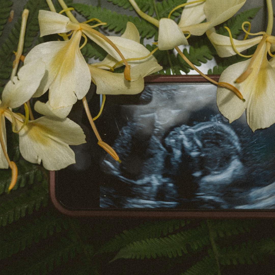 Photo shared by Savannah for their Babylist baby registry.