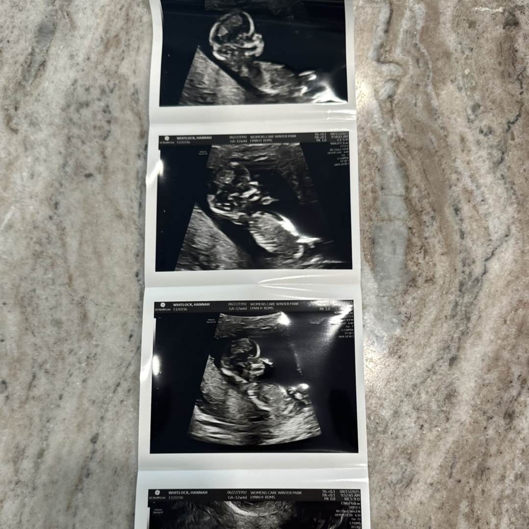 Photo shared by Hannah for their Babylist baby registry.