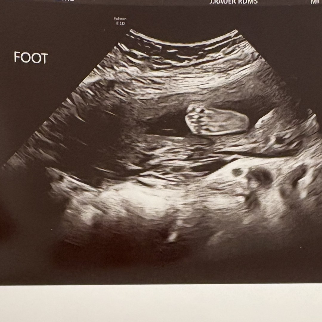 Photo shared by Rebecca for their Babylist baby registry.