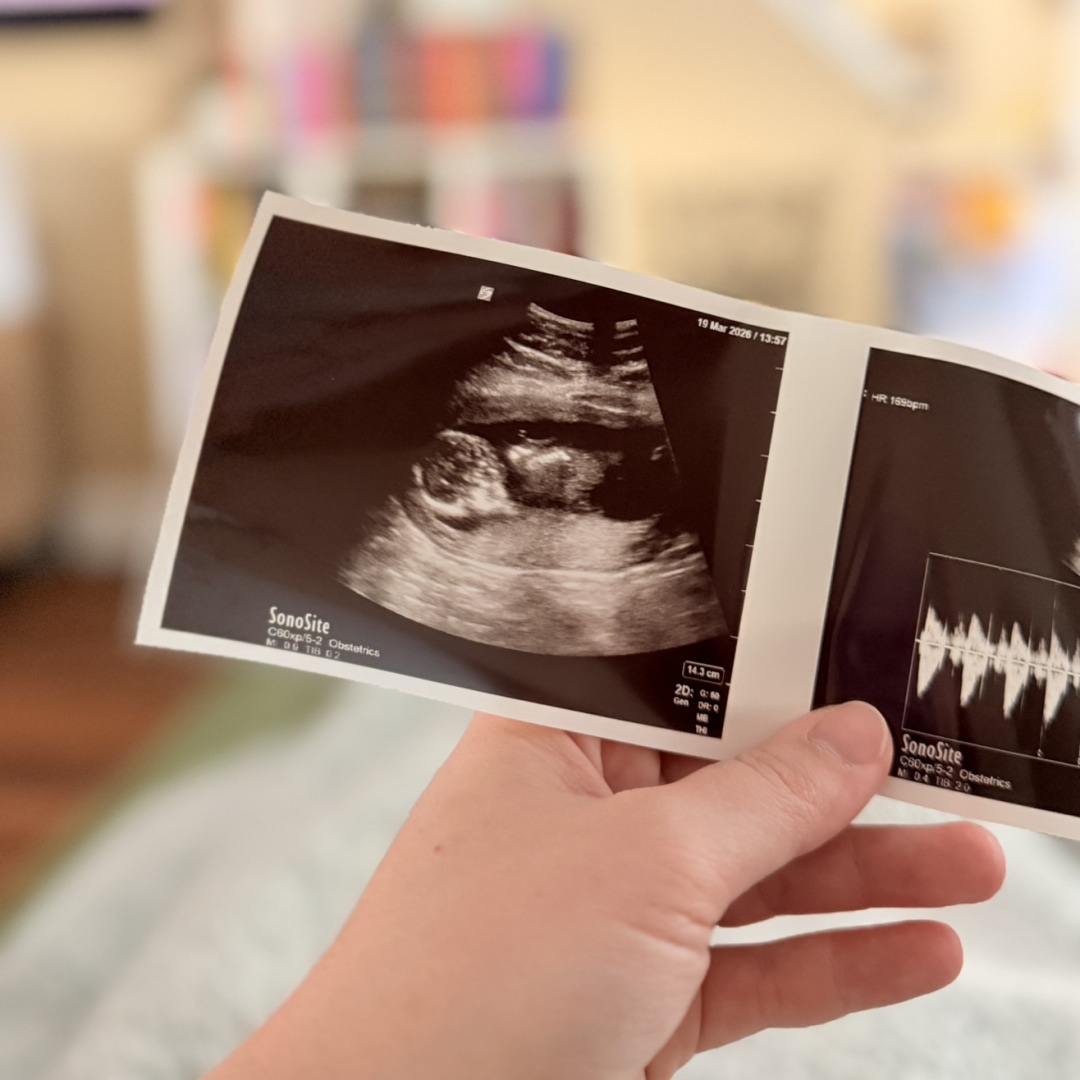 Photo shared by Haileigh for their Babylist baby registry.