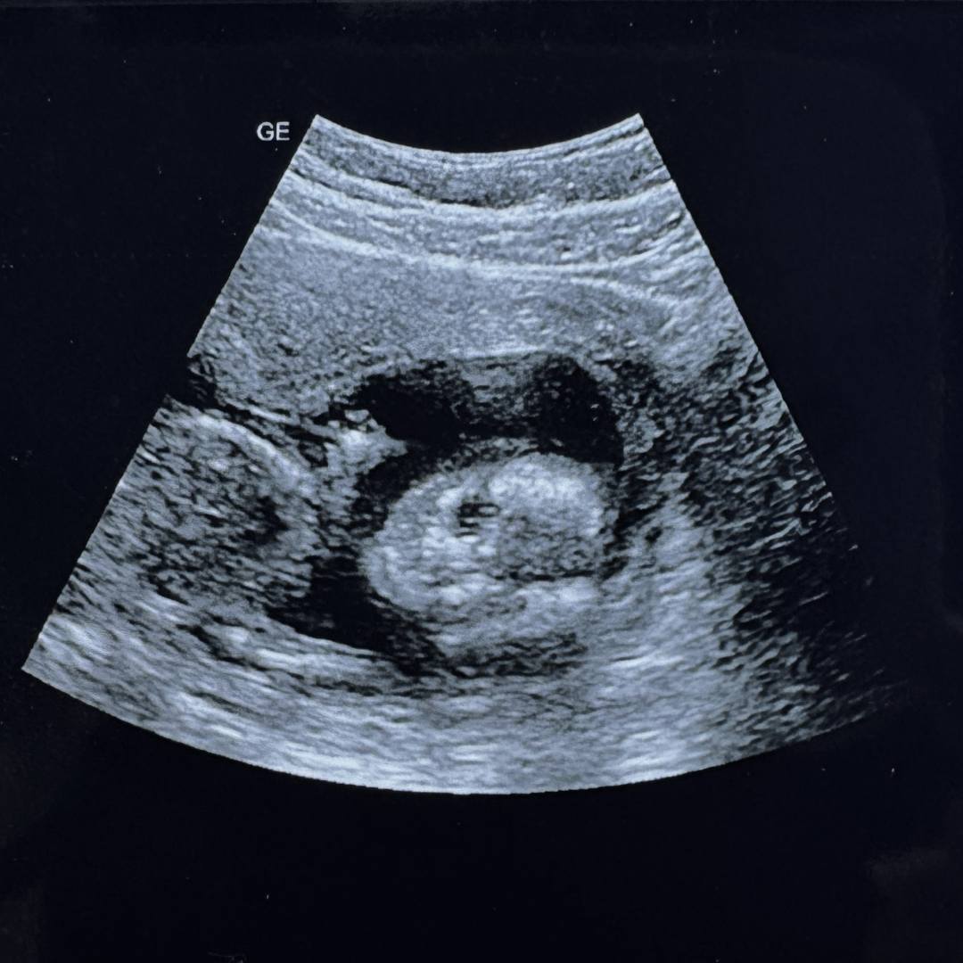Photo shared by Diana for their Babylist baby registry.