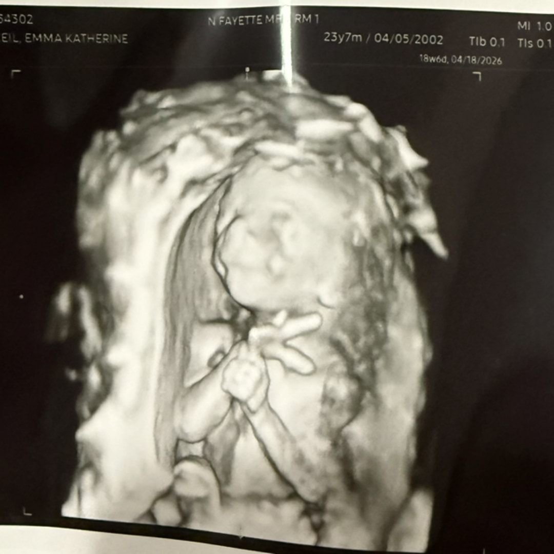 Photo shared by Emma for their Babylist baby registry.