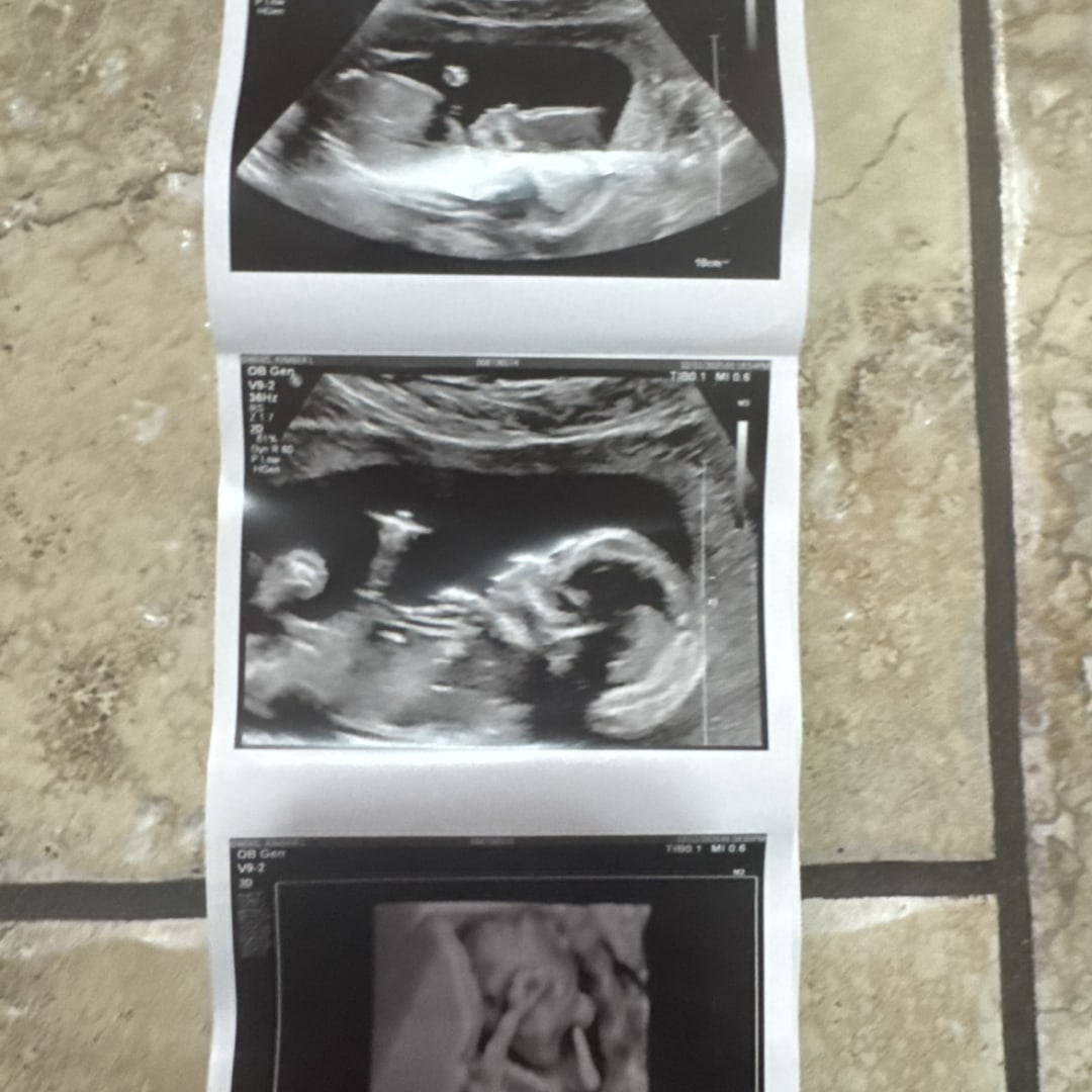 Photo shared by Kimber for their Babylist baby registry.