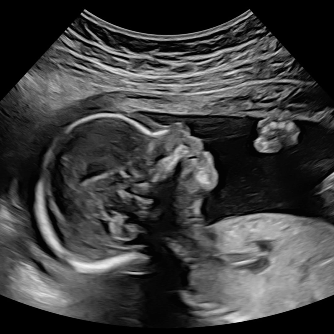 Photo shared by Claudia for their Babylist baby registry.