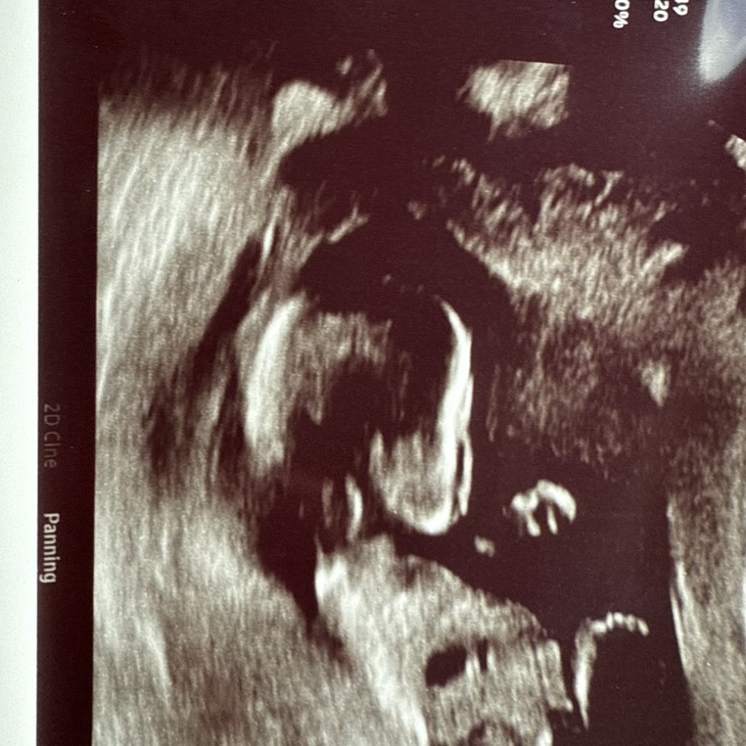 Photo shared by Abiut for their Babylist baby registry.