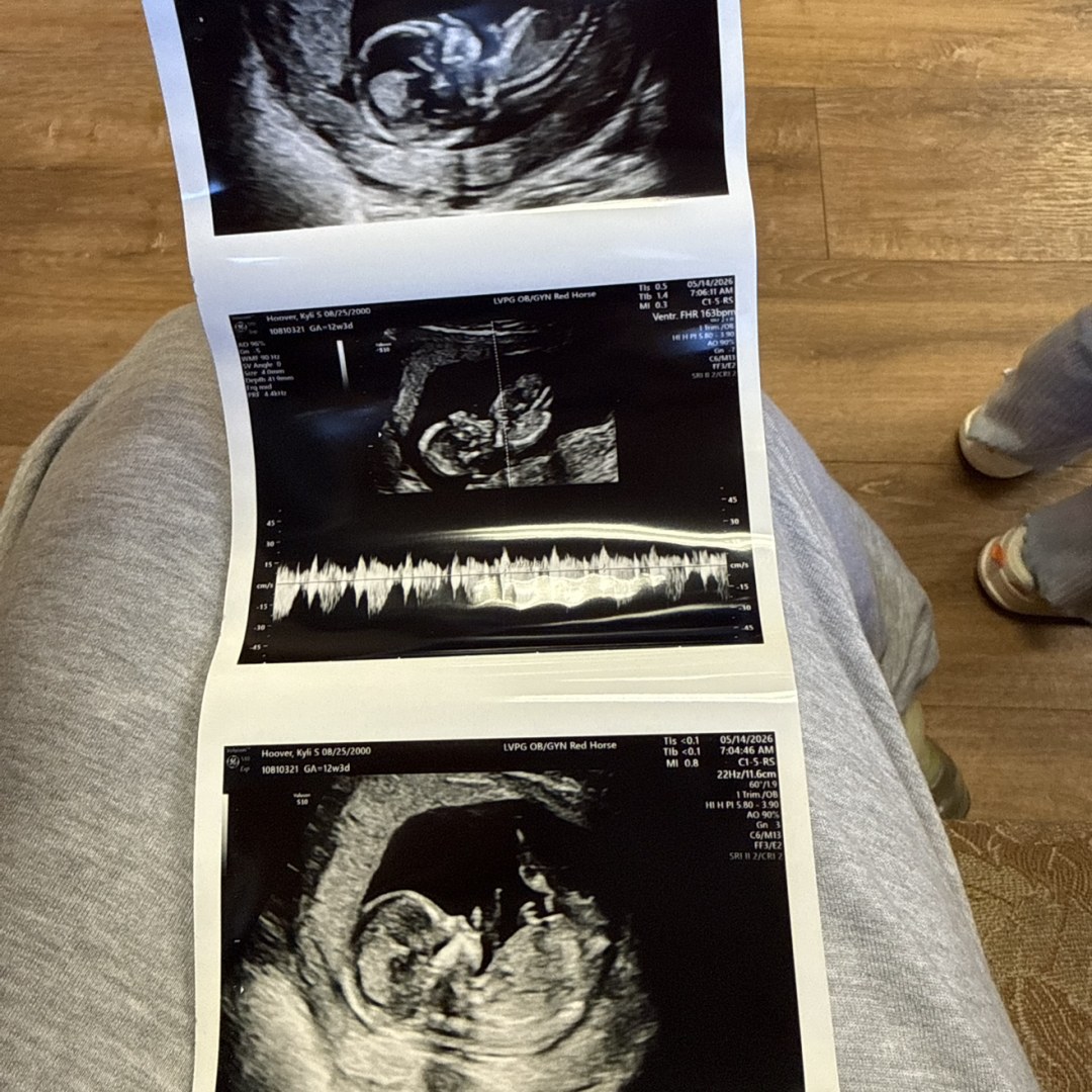 Photo shared by Kyli for their Babylist baby registry.
