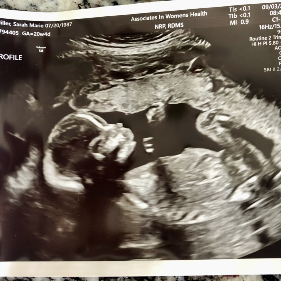 Photo shared by Sarah for their Babylist baby registry.