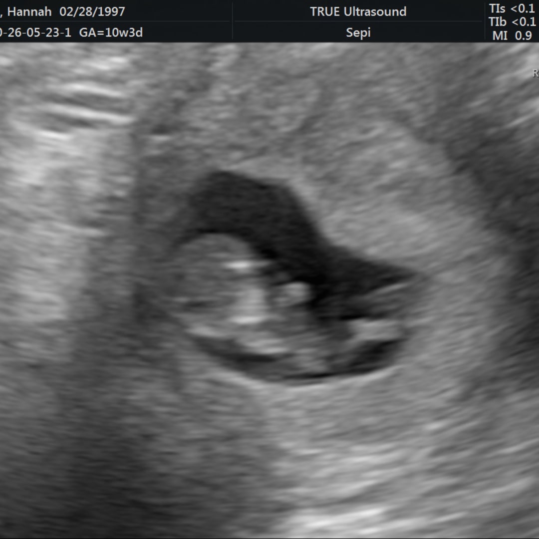 Photo shared by Hannah for their Babylist baby registry.