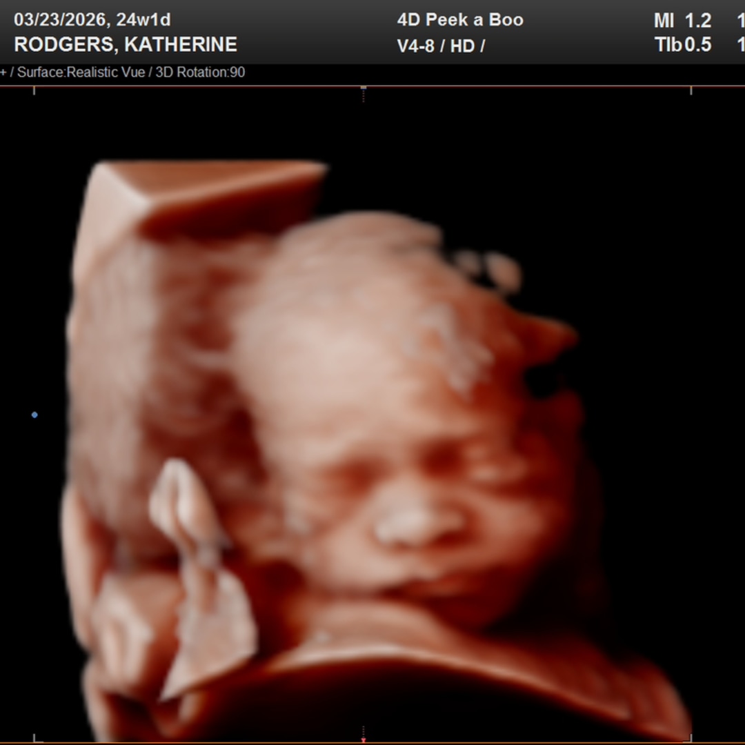 Photo shared by Katherine for their Babylist baby registry.