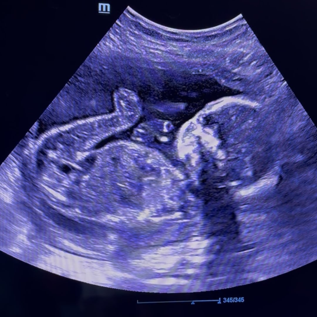 Photo shared by Abbi for their Babylist baby registry.