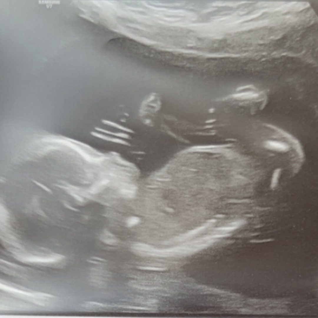 Photo shared by Lacey for their Babylist baby registry.