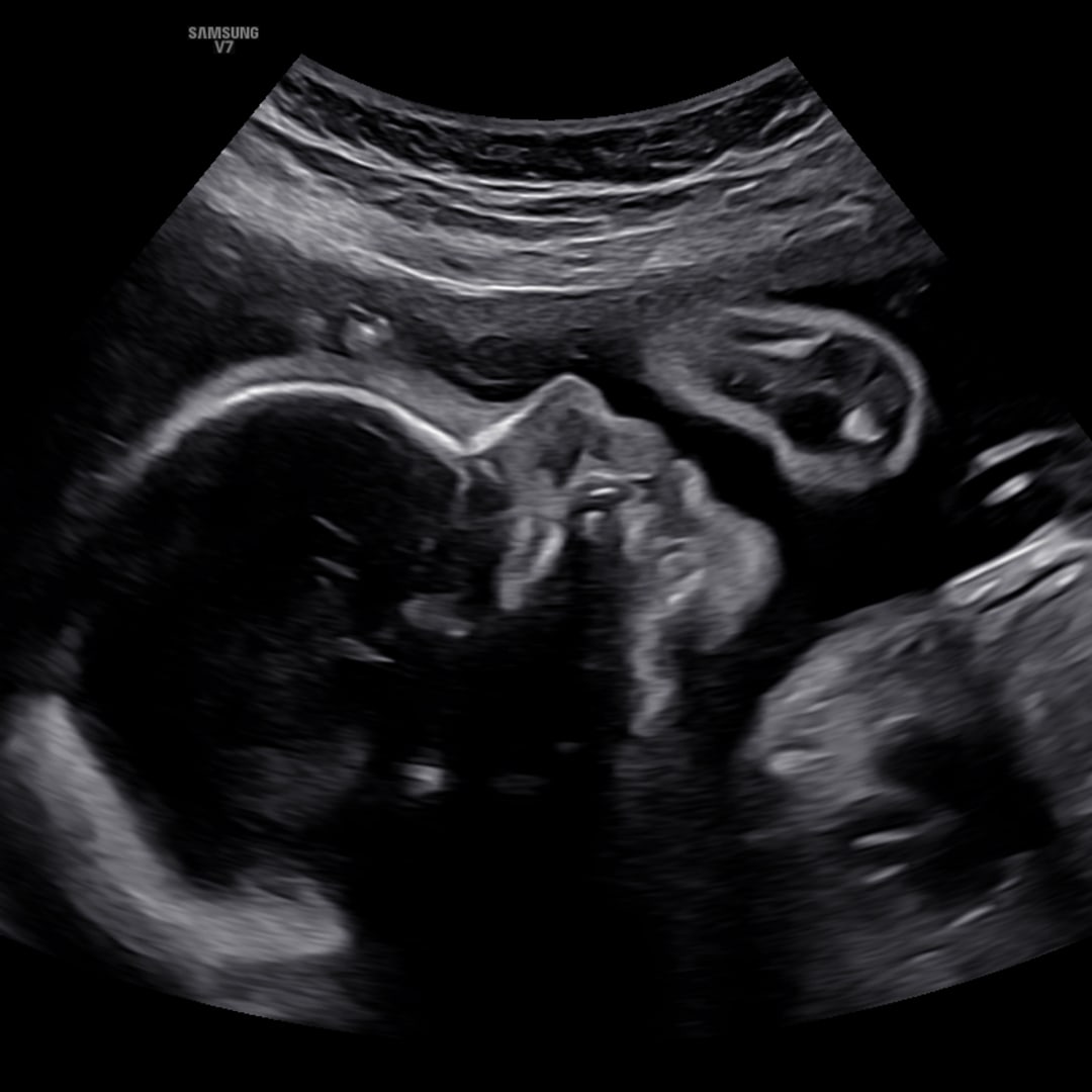 Photo shared by Aly for their Babylist baby registry.
