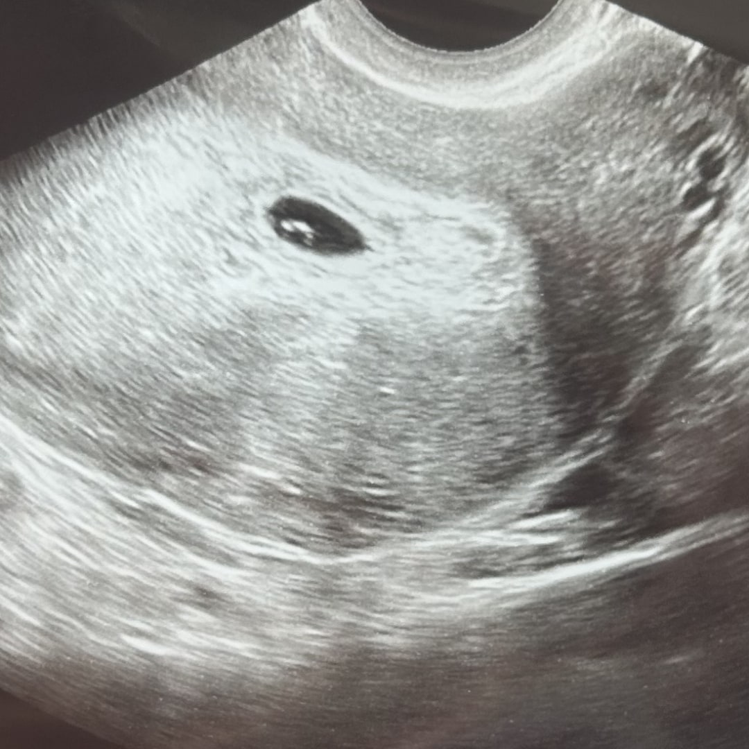 Photo shared by Victoria for their Babylist baby registry.