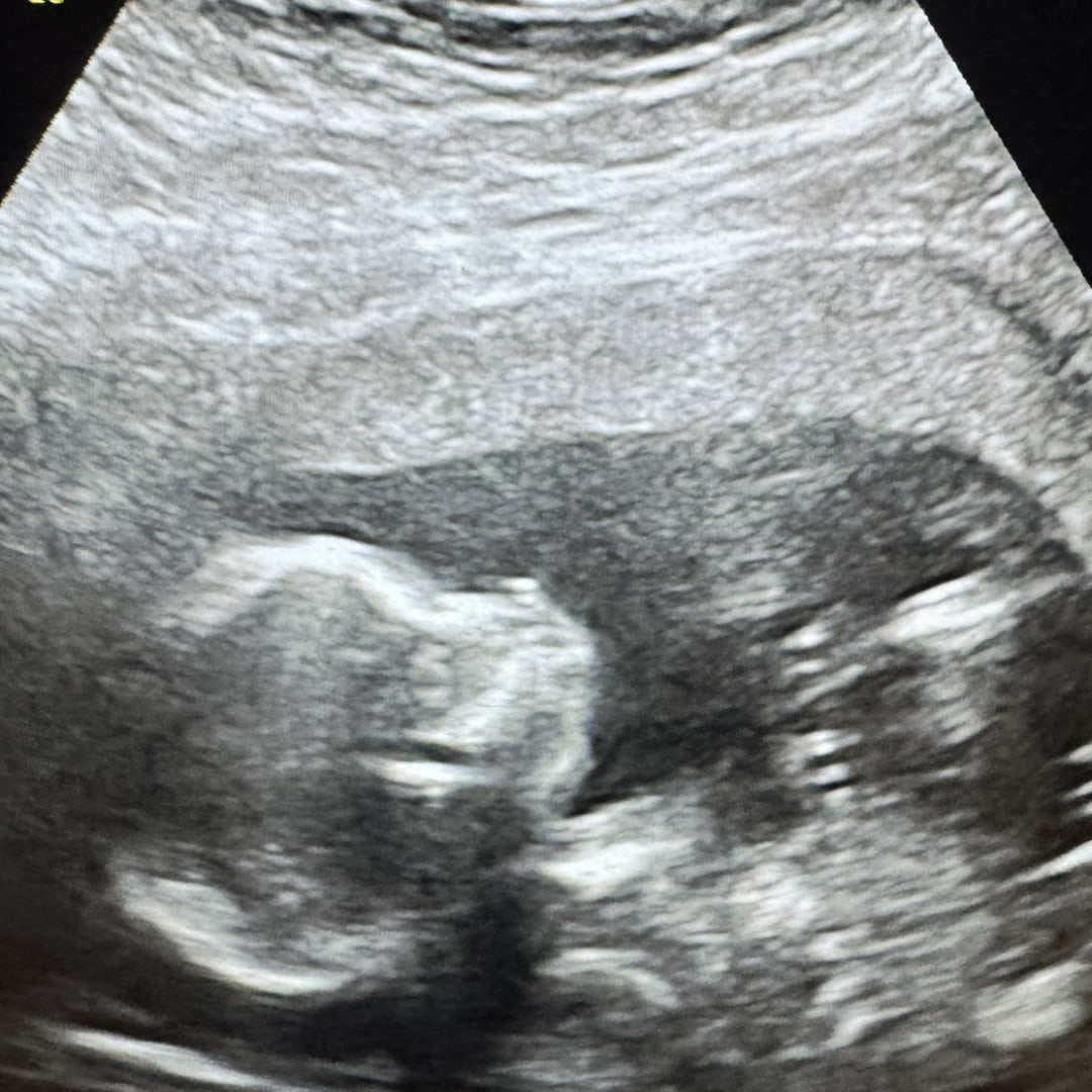 Photo shared by Alicia for their Babylist baby registry.