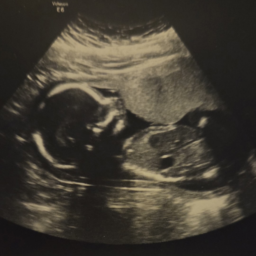 Photo shared by Danielle for their Babylist baby registry.