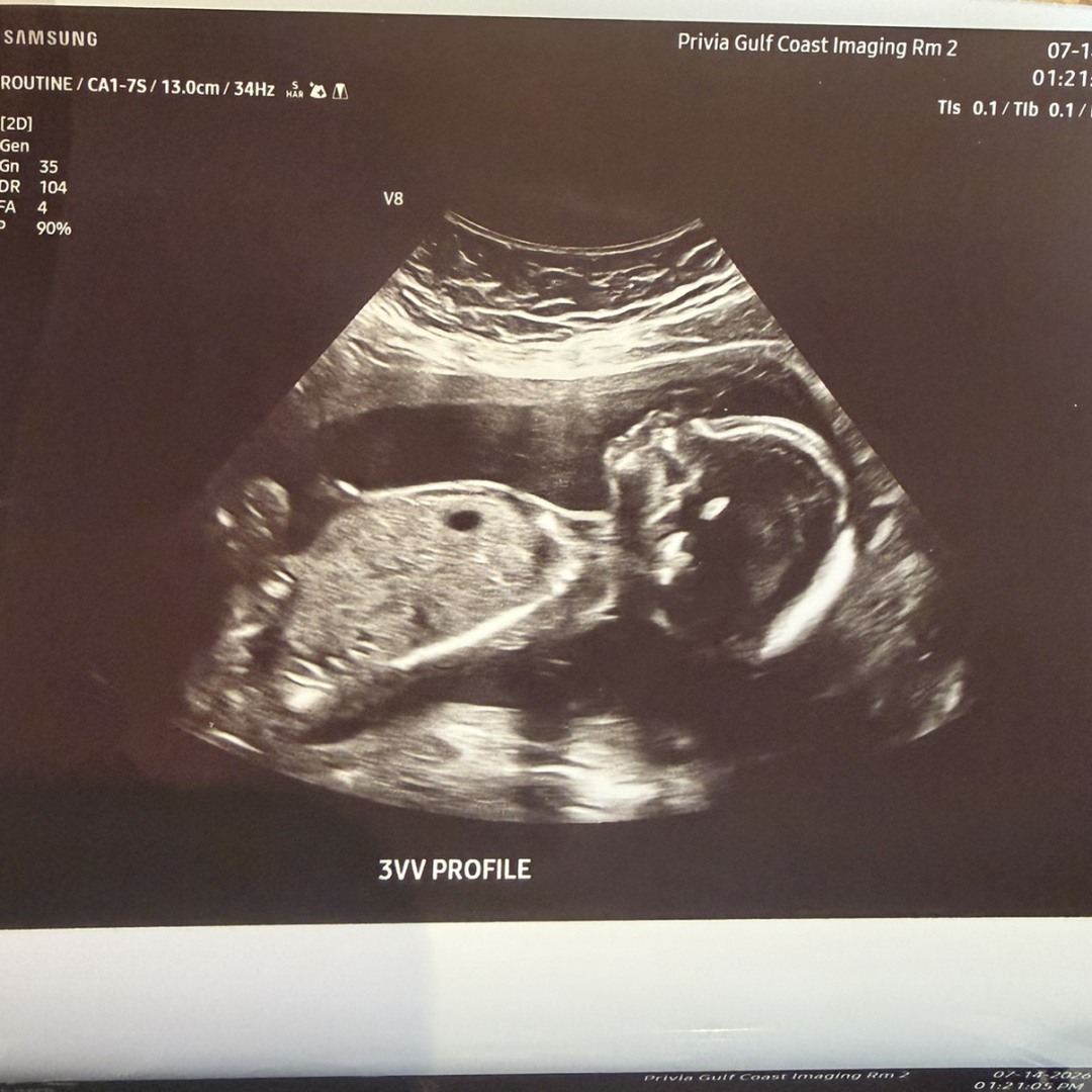 Photo shared by Chassidy for their Babylist baby registry.