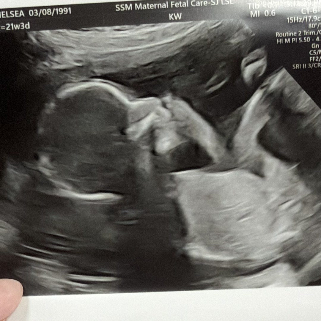 Photo shared by Chelsea for their Babylist baby registry.