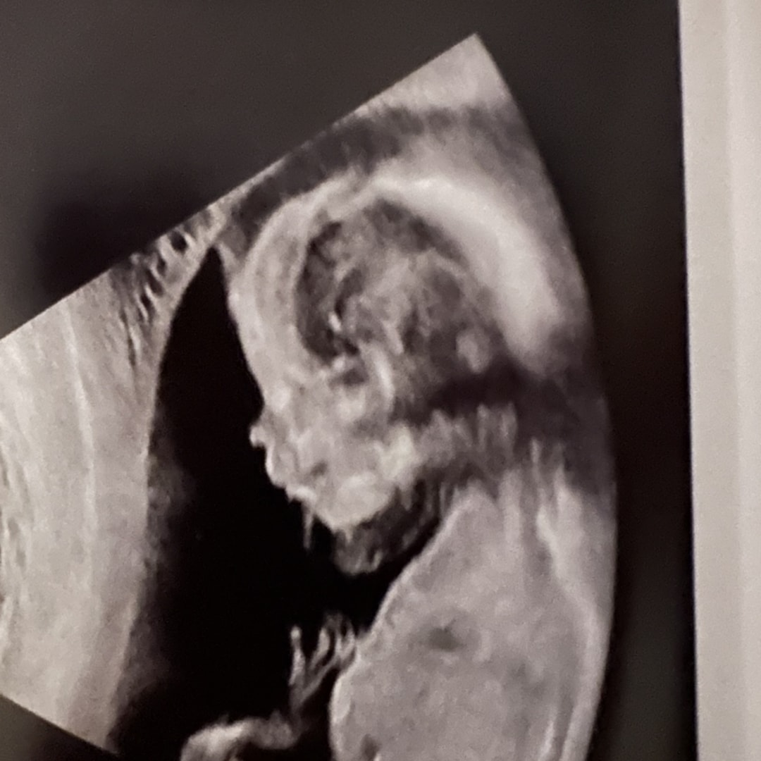 Photo shared by Bowin for their Babylist baby registry.