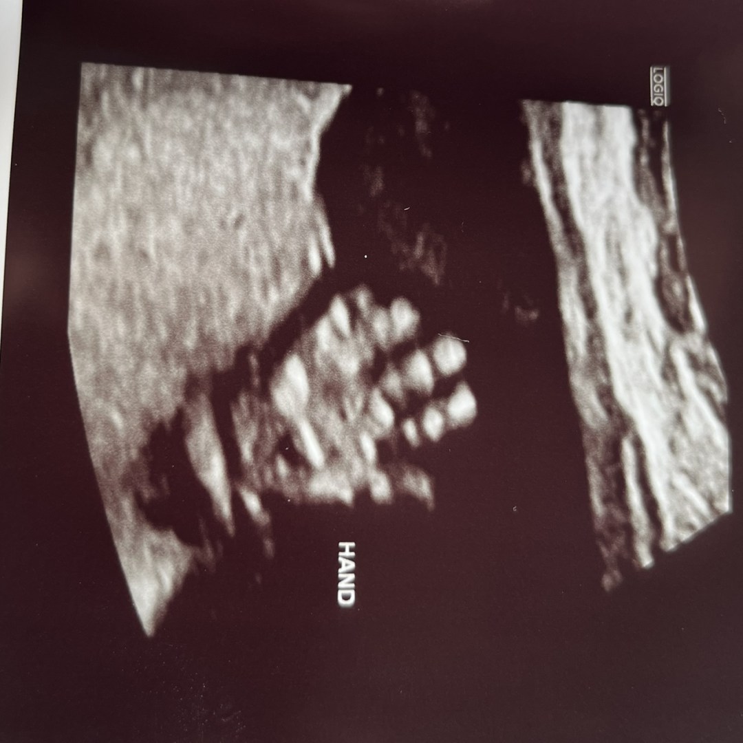 Photo shared by Elvira Marien for their Babylist baby registry.