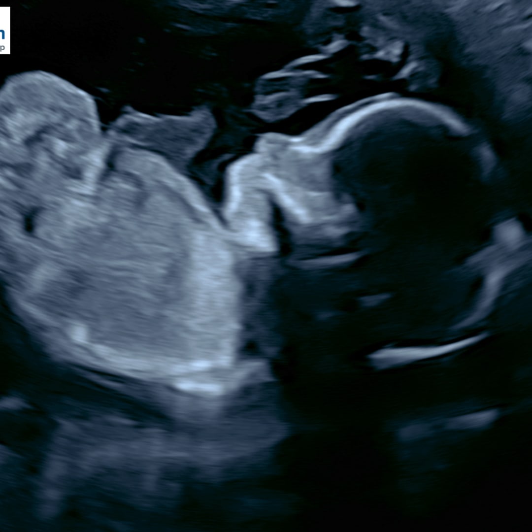 Photo shared by Vanessa for their Babylist baby registry.