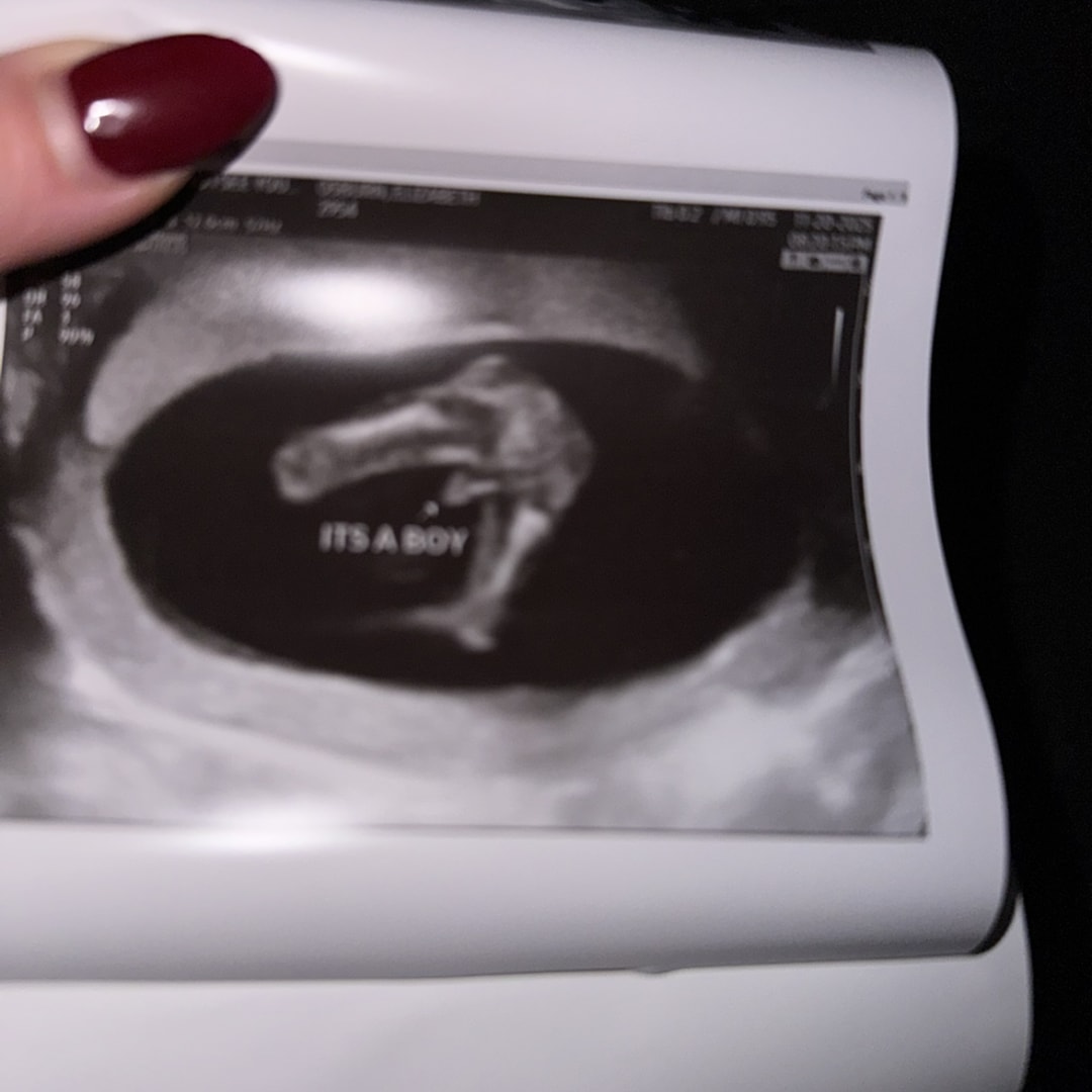 Photo shared by Elizabeth for their Babylist baby registry.