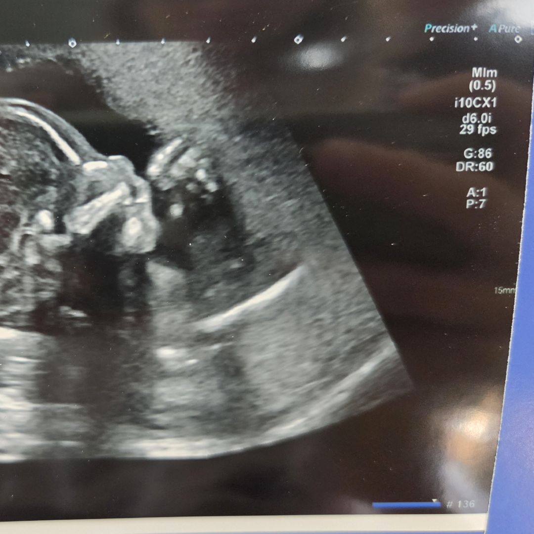 Photo shared by Assaf & Megan for their Babylist baby registry.