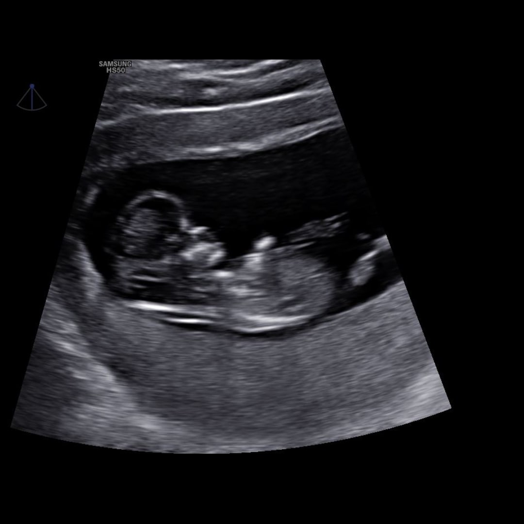 Photo shared by Chloe for their Babylist baby registry.