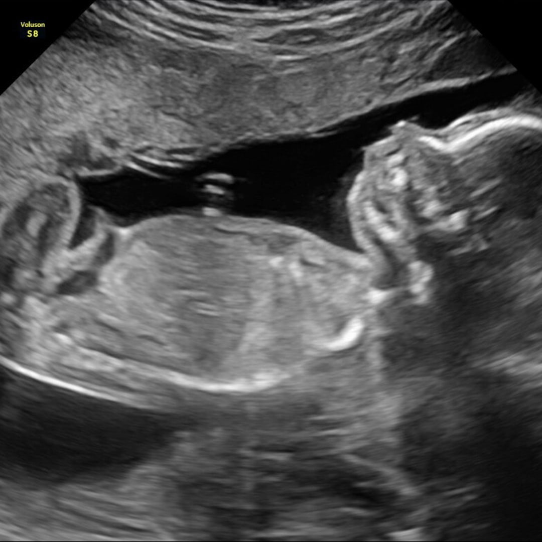Photo shared by Celeste for their Babylist baby registry.