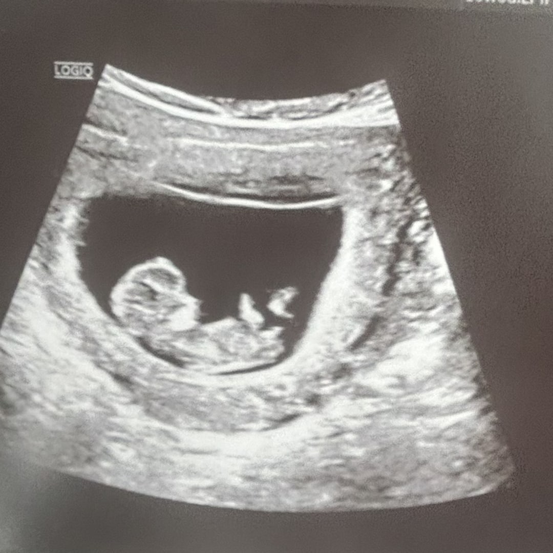 Photo shared by Richard for their Babylist baby registry.